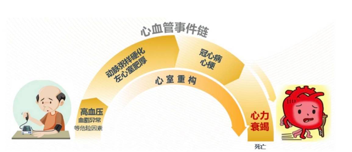 心血管事件链共识（心血管事件缩写）